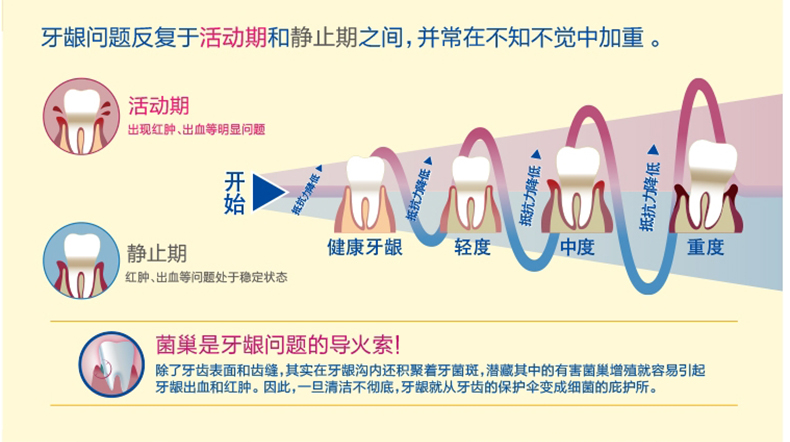 狮王 牙刷 细齿洁弹力护龈 